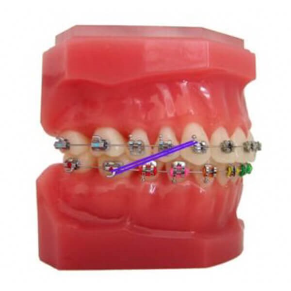 Elastic Class 2