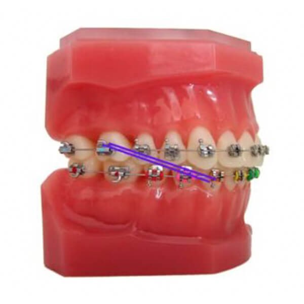 Elastics Class 3