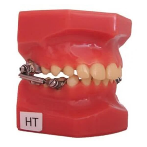 Herbst Appliance