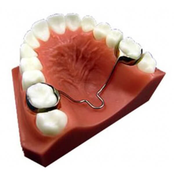 Elastics Class 3