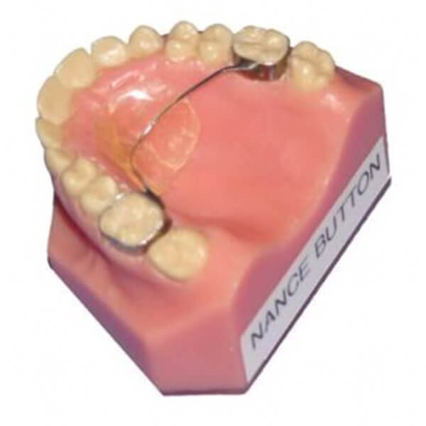 Elastics Triangle